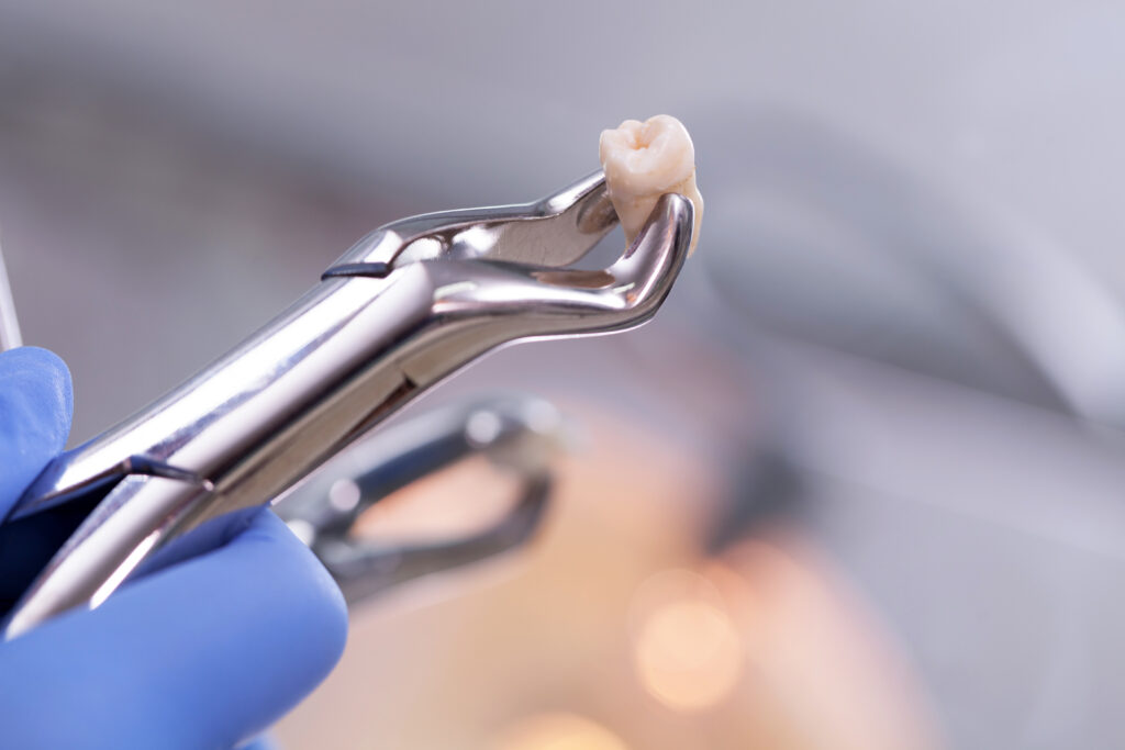 Dental equipment,tooth extraction