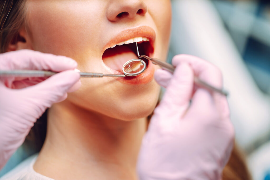 Overview of dental caries prevention. Dentist examining patient'